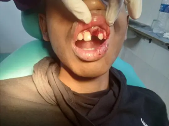 Dental Camp Goregaon